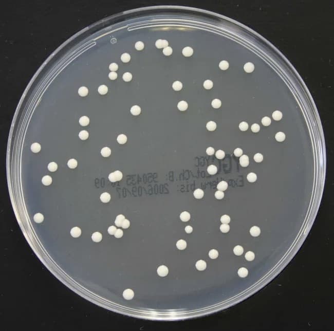Sample photo: Bacterial colonies